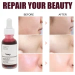 سرم لایه بردار پیلینگ سلوشن AHA و BHA اوردینری