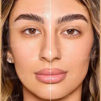تینت پوست شیگلم