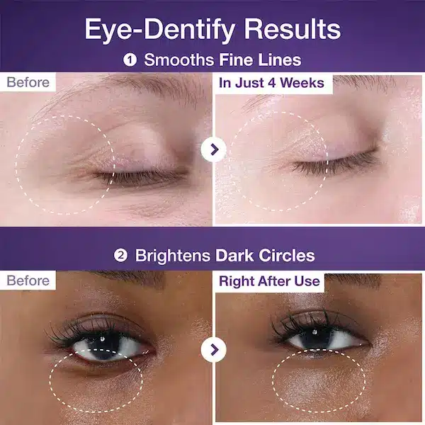 سرم دور چشم NAD+ و رتینول شماره ۹ نامبوزین سرم دور چشم NAD+ و رتینول شماره ۹ نامبوزین