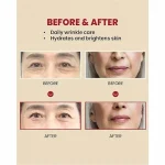 کرم ضد پیری رتینال لیپوزوم ۱٪ و برنج تخمیری سئول 1988 کی سکرت